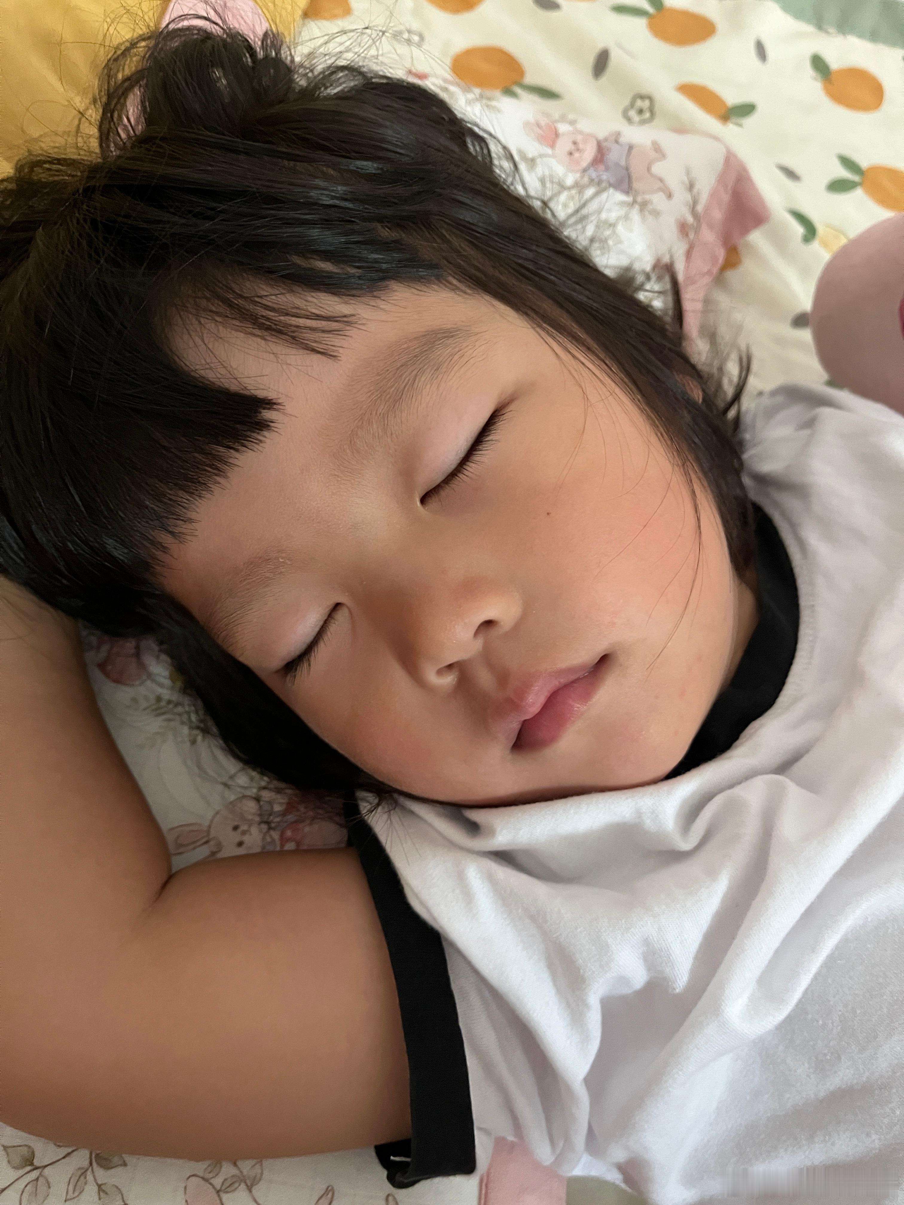 怎么那么小的孩子，也会长痣，好像是去年长得的，第一次看到的时候很惊讶，我以为要1
