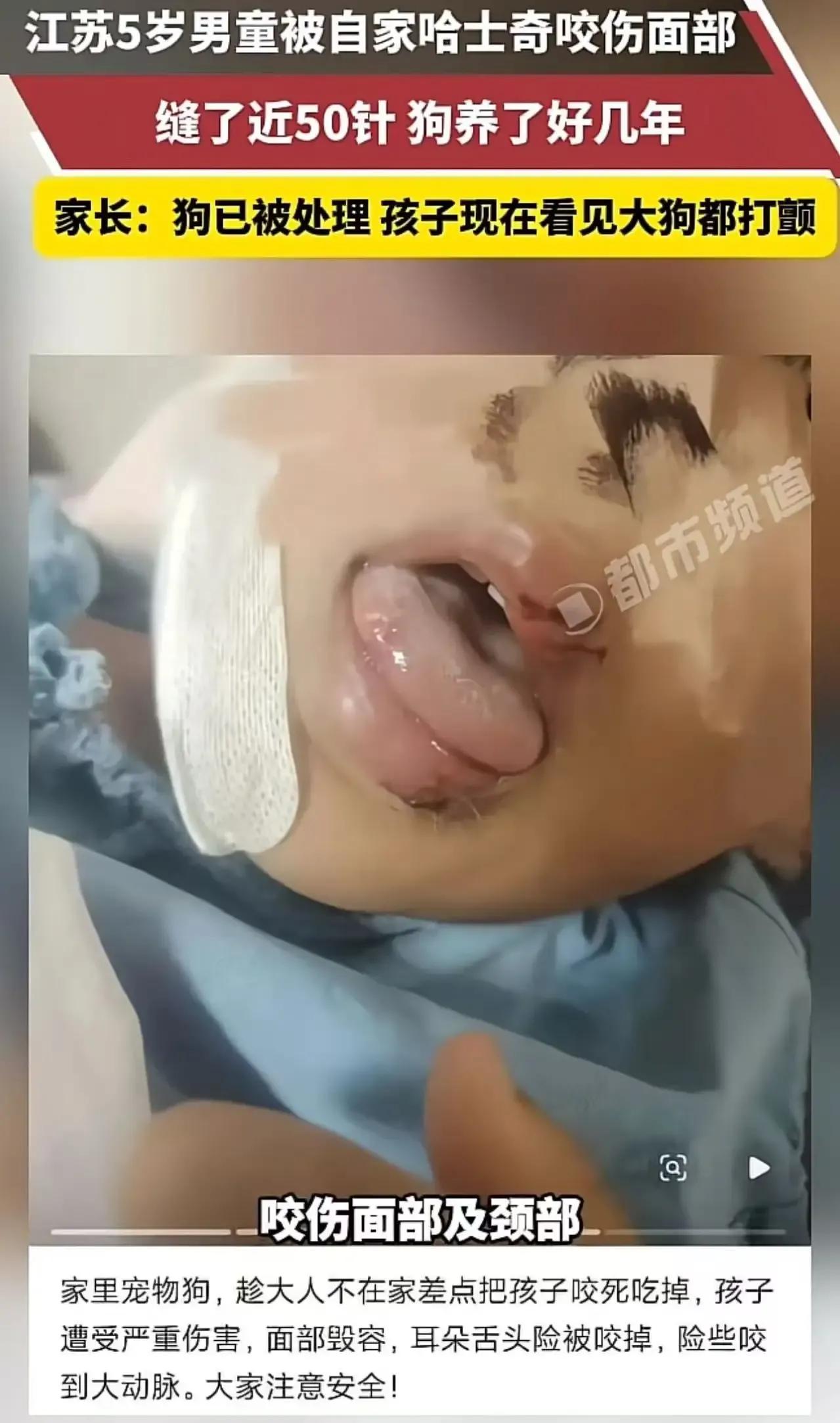 “这下养狗的都被干沉默了！”近日，江苏一5岁男童被自家养了好几年的哈士奇咬伤面部