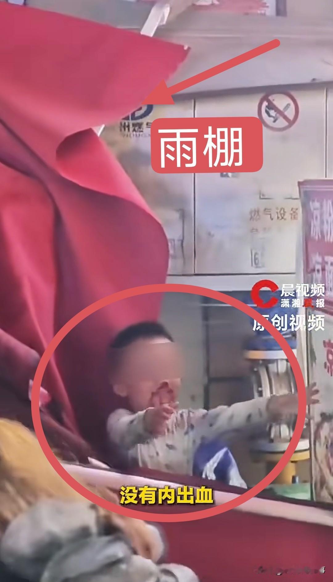 惊险一幕！贵阳，一个3岁男孩从10楼掉下来，正好砸在楼下水果店的雨棚上。他口鼻流