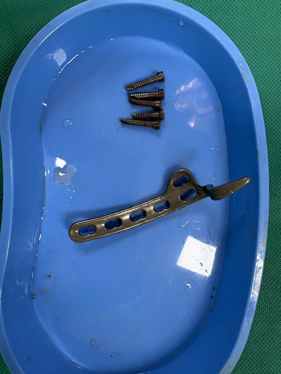 陈哲远回应回深圳做手术 陈哲远报平安了 陈哲远报平安了！ 