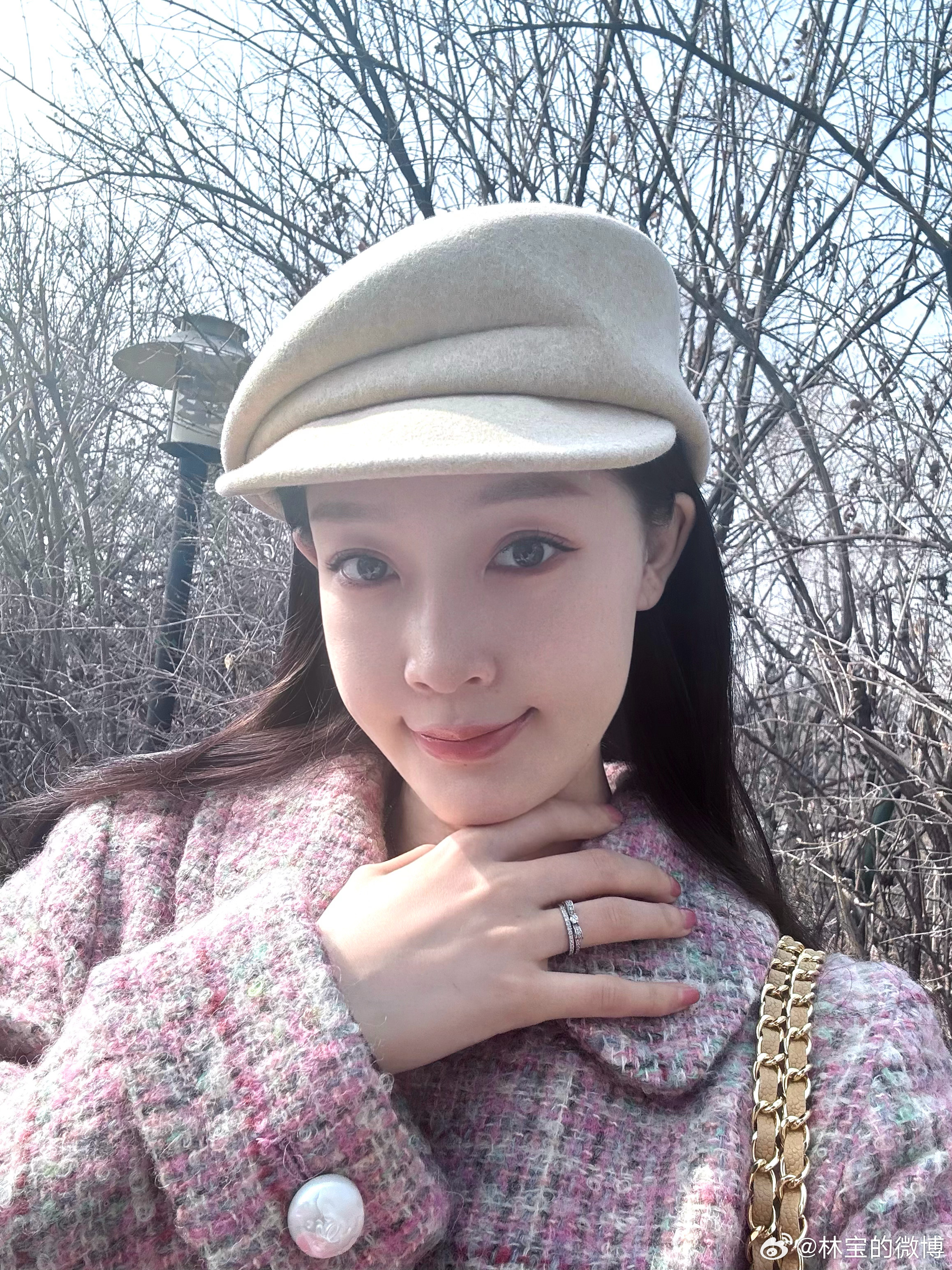 早知道不戴帽子了 卡额头