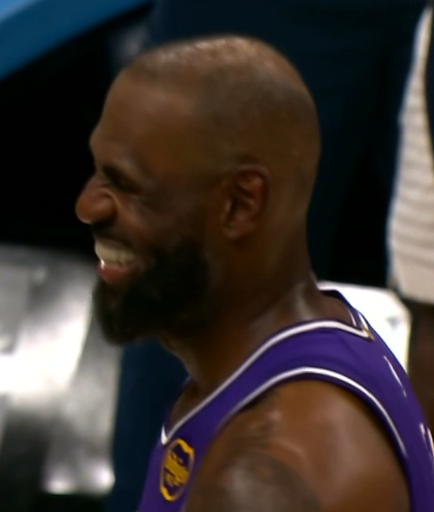 灯光一打像戴了个小白帽。洛杉矶湖人