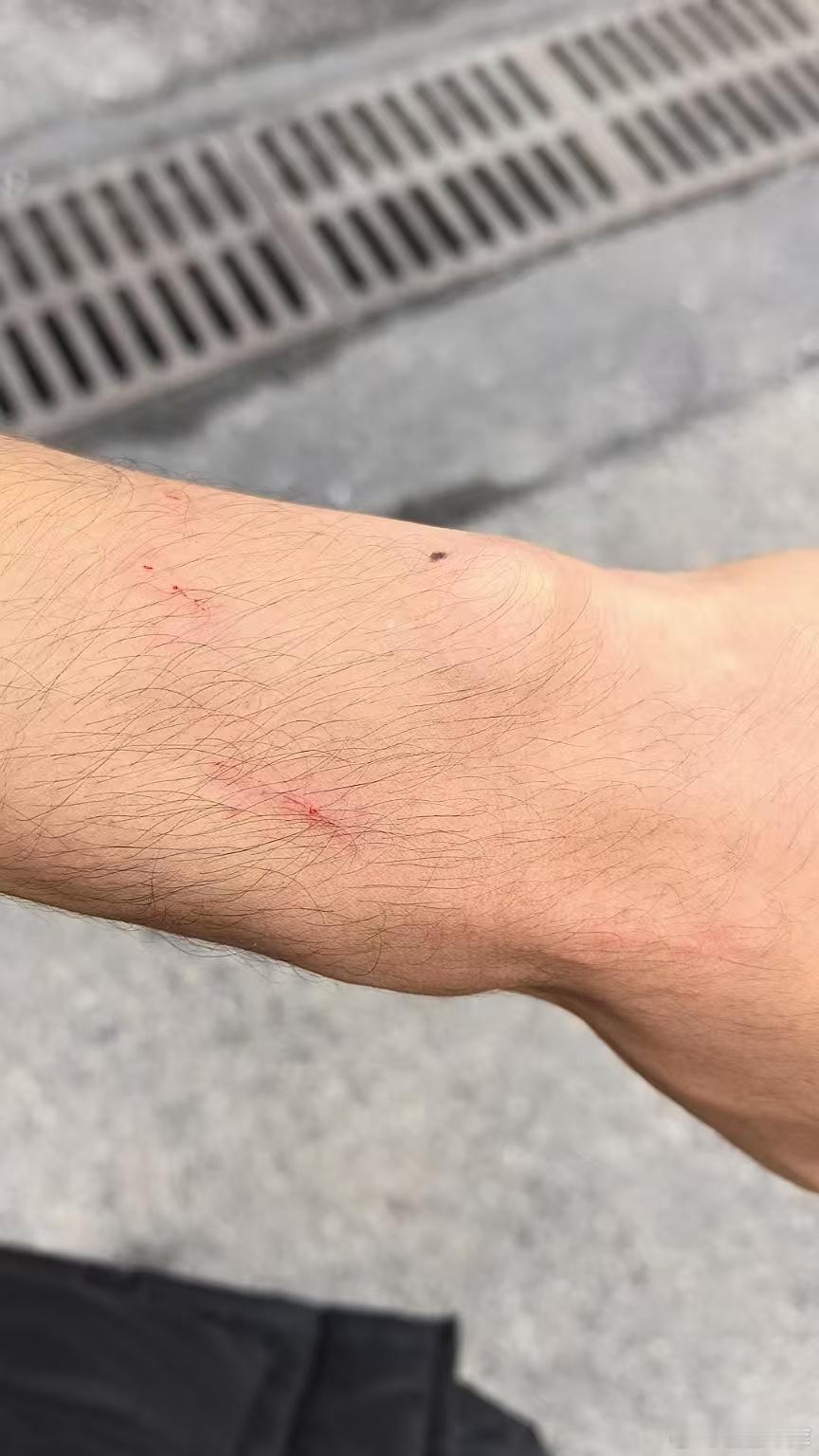 MD 豆白又咬人了