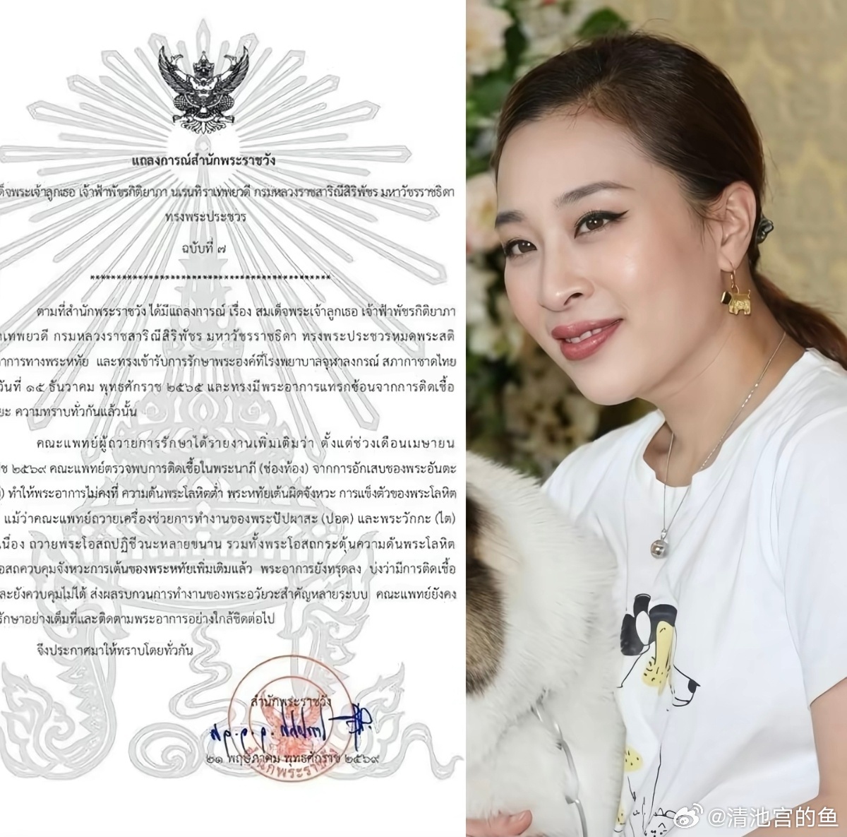 泰国长公主昏迷近3年半后病情恶化如果这位长公主的公开生日是真的，那就凶多吉少了，