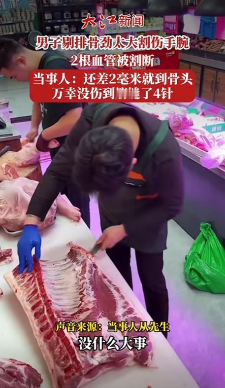 “太吓人了！”5月6日报道，浙江宁波，一男子剔排骨时，劲用得太大，不小心割伤手腕