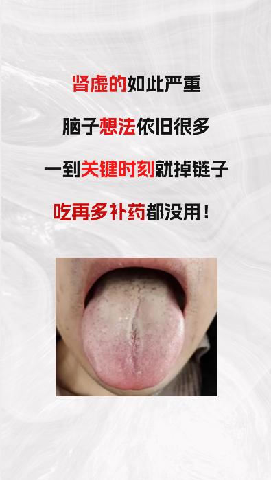 肾虚的如此严重，脑子想法还很多，但一到关键时刻就掉链子，吃了很多补药 但没有用