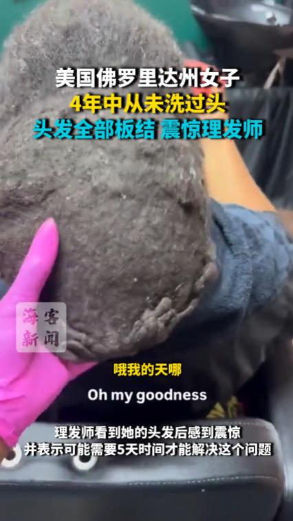 “佛罗里达不养闲人！”美国佛罗里达州，一名女子竟然四年没有洗头，日常靠着头巾遮挡