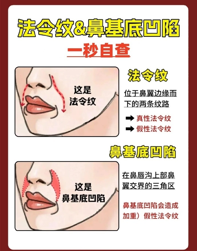 很多人分不清法令纹和鼻基底凹陷，其实有个简单的自测方法👇 法令纹 鼻基底凹陷 