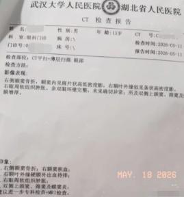 灭绝人性！江西一名13岁男孩因性格叛逆，被父母花费3.28万元将其送入一家成长特
