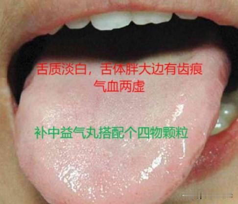 补中益气丸除了补脾胃，搭配好还能补气养血、滋阴填精、补肾助阳
1.补气养血
补中