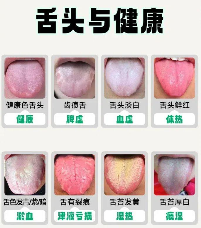 小舌头，大学问，藏在舌象里的健康问题你都了解吗？

舌诊是我们中医看诊时的方法之