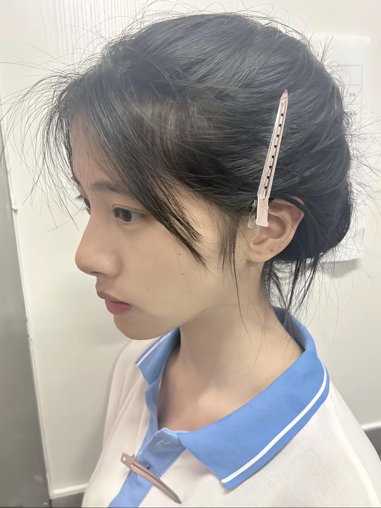 回复 @少吃点的评论 用的afae洗面奶