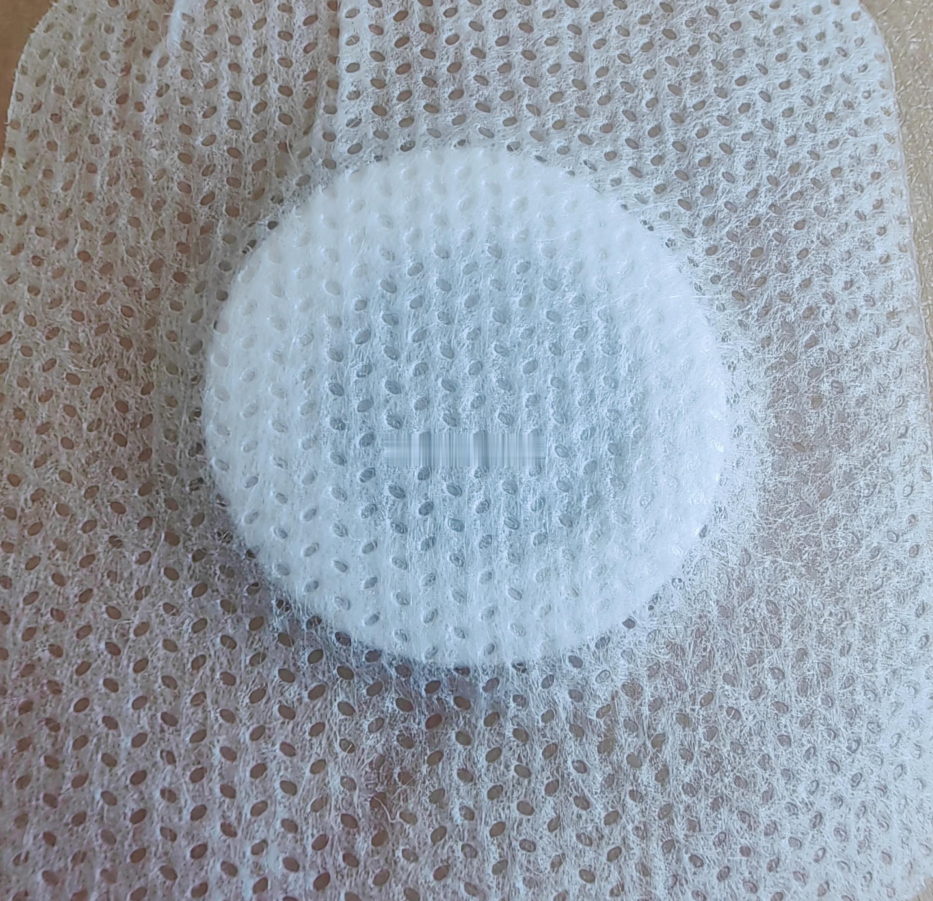 生活手记初伏第一天，回中医科贴上初伏贴，后天跟上初伏灸，中医同事给安排的明明白白