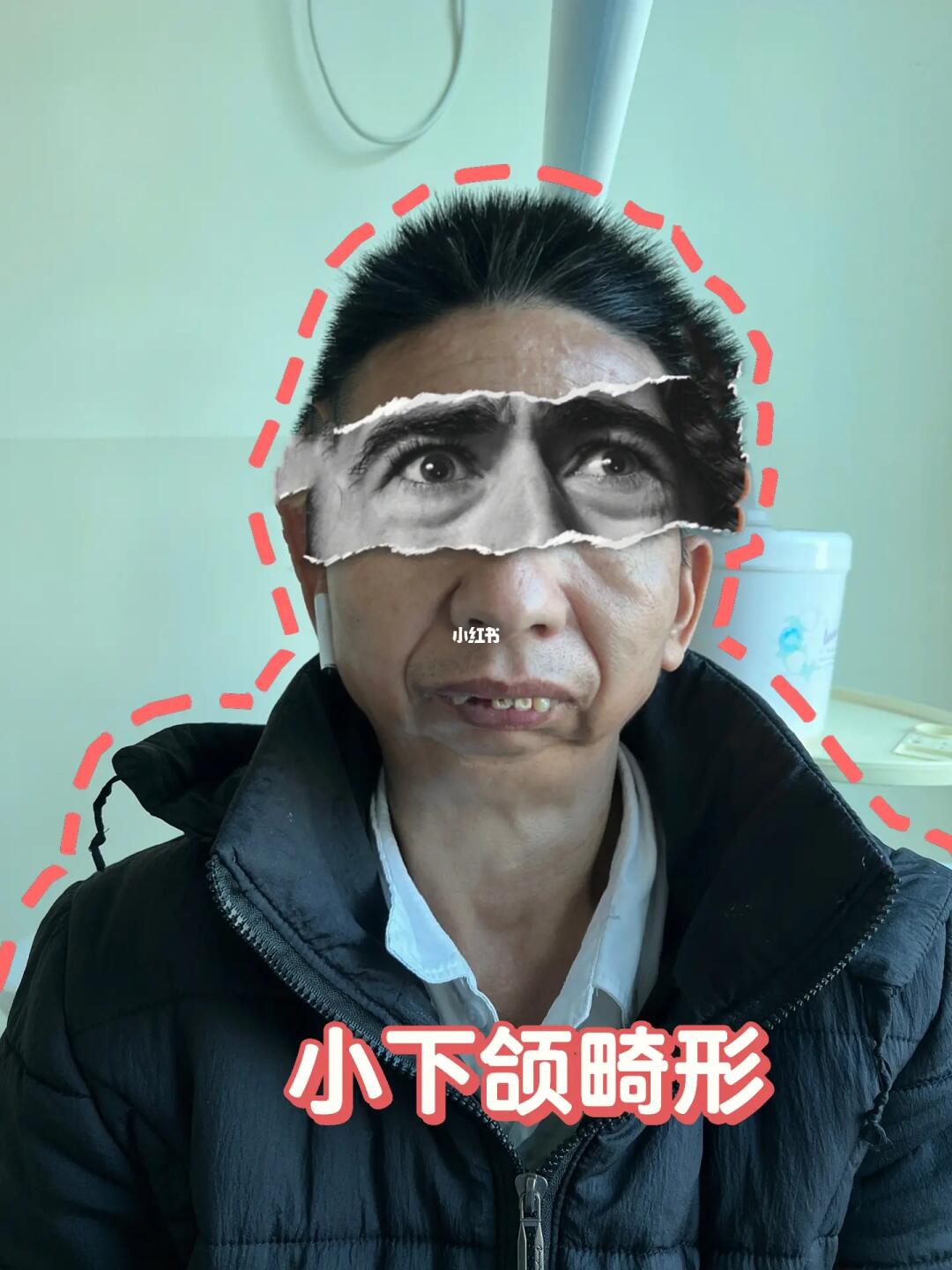 天啊～这人为什么没有下巴？
