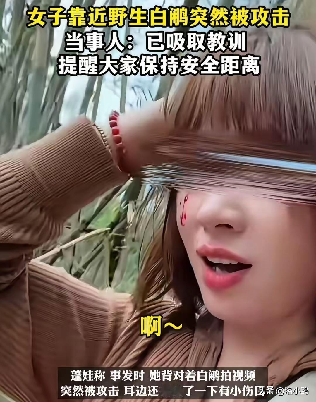 人真的不能太有爱心，
这个女孩给大家上了惨痛的一课！

事情大概：这个年轻女孩出