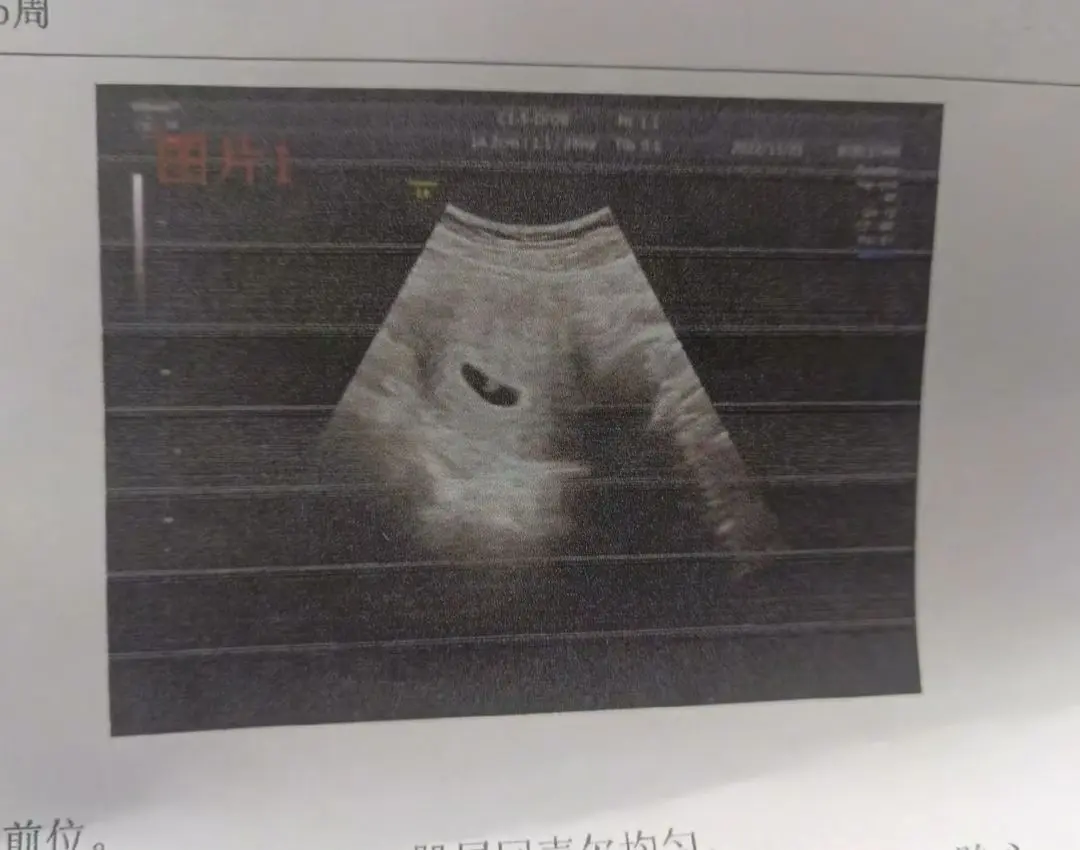 “你来一程 我念一生”