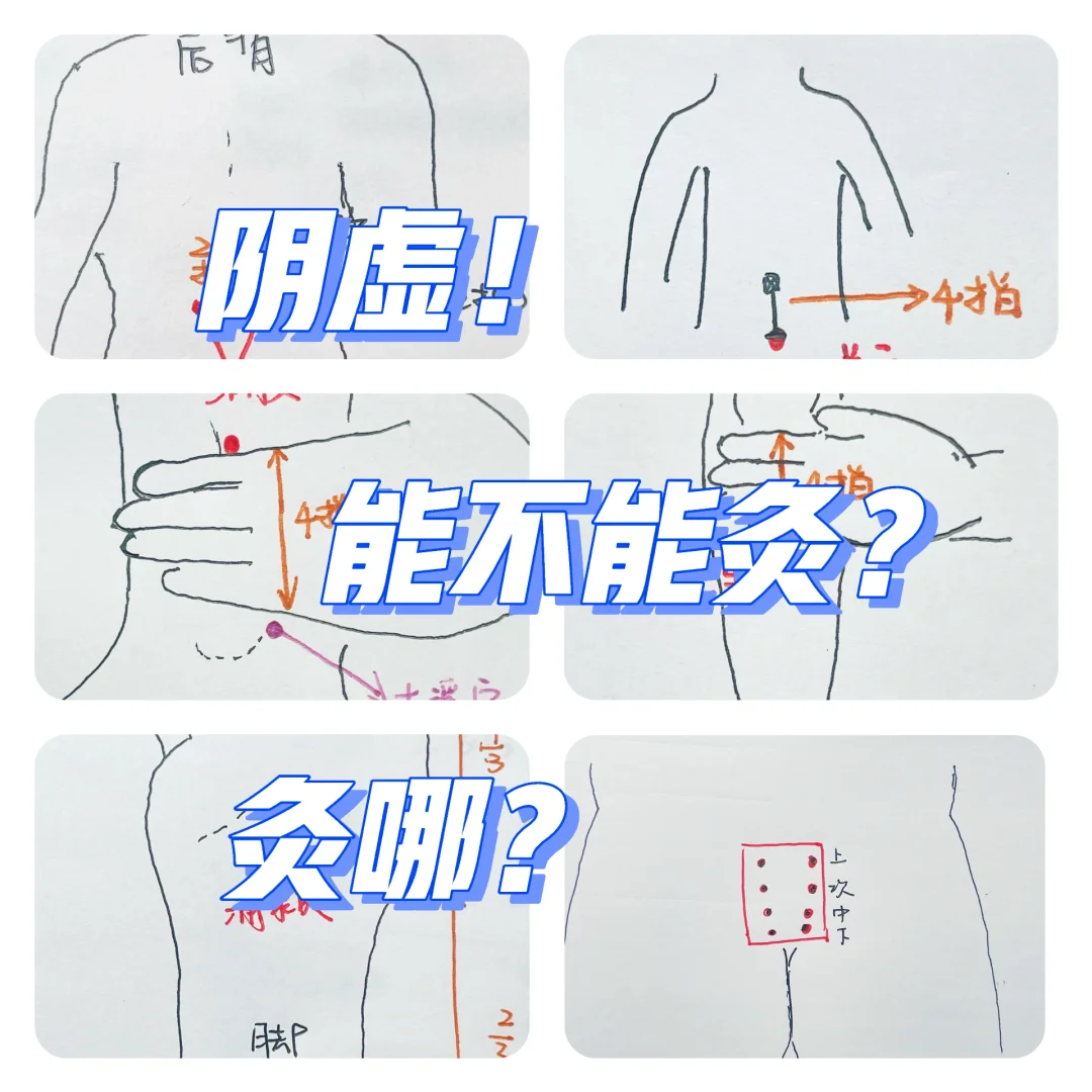 阴🕳️能否艾｜灸❓（如何灸➕先后顺序