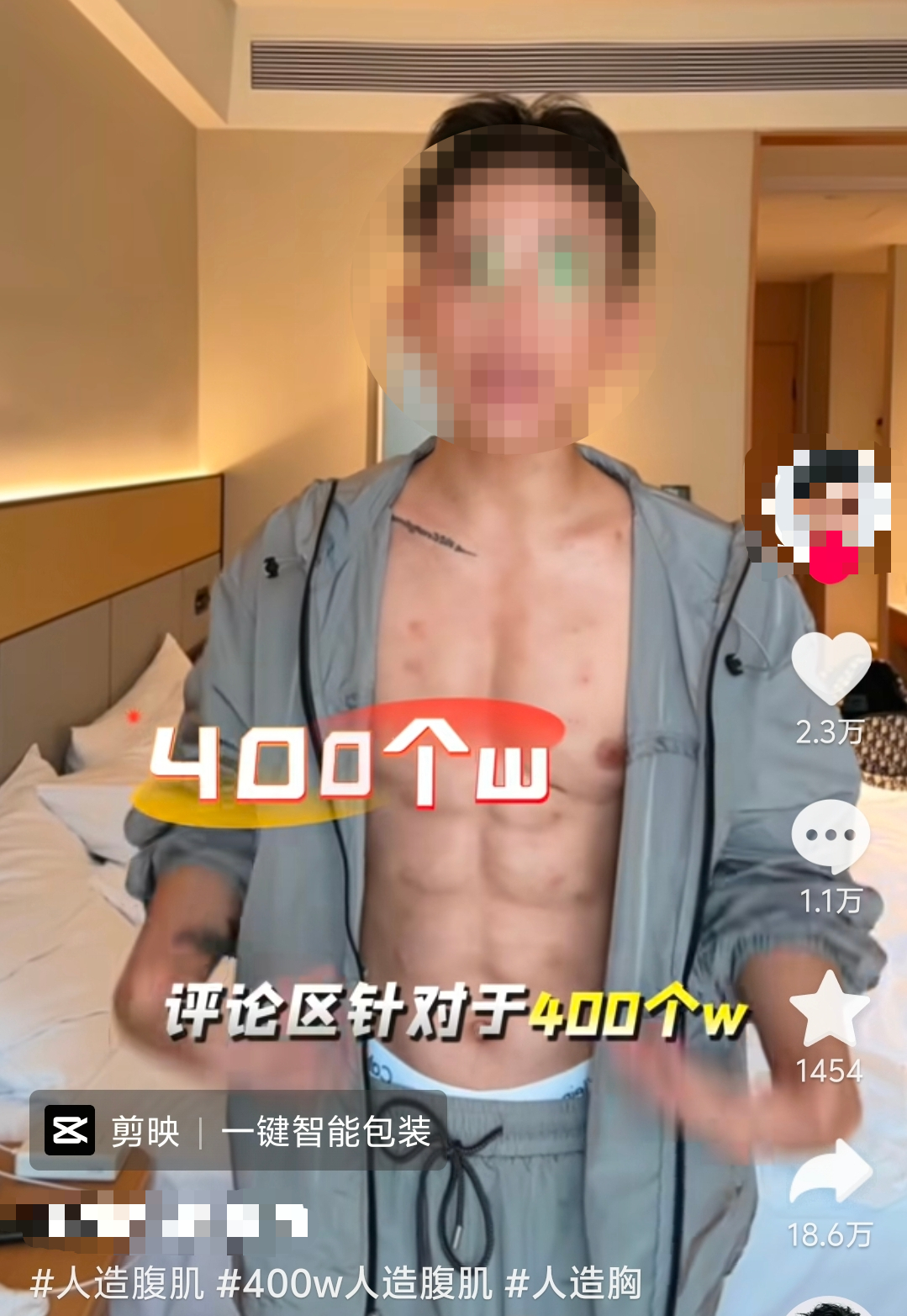 #卫健委回应医美机构用玻尿酸造腹肌# 【#多家医美机构推玻尿酸造腹肌#】红星资本