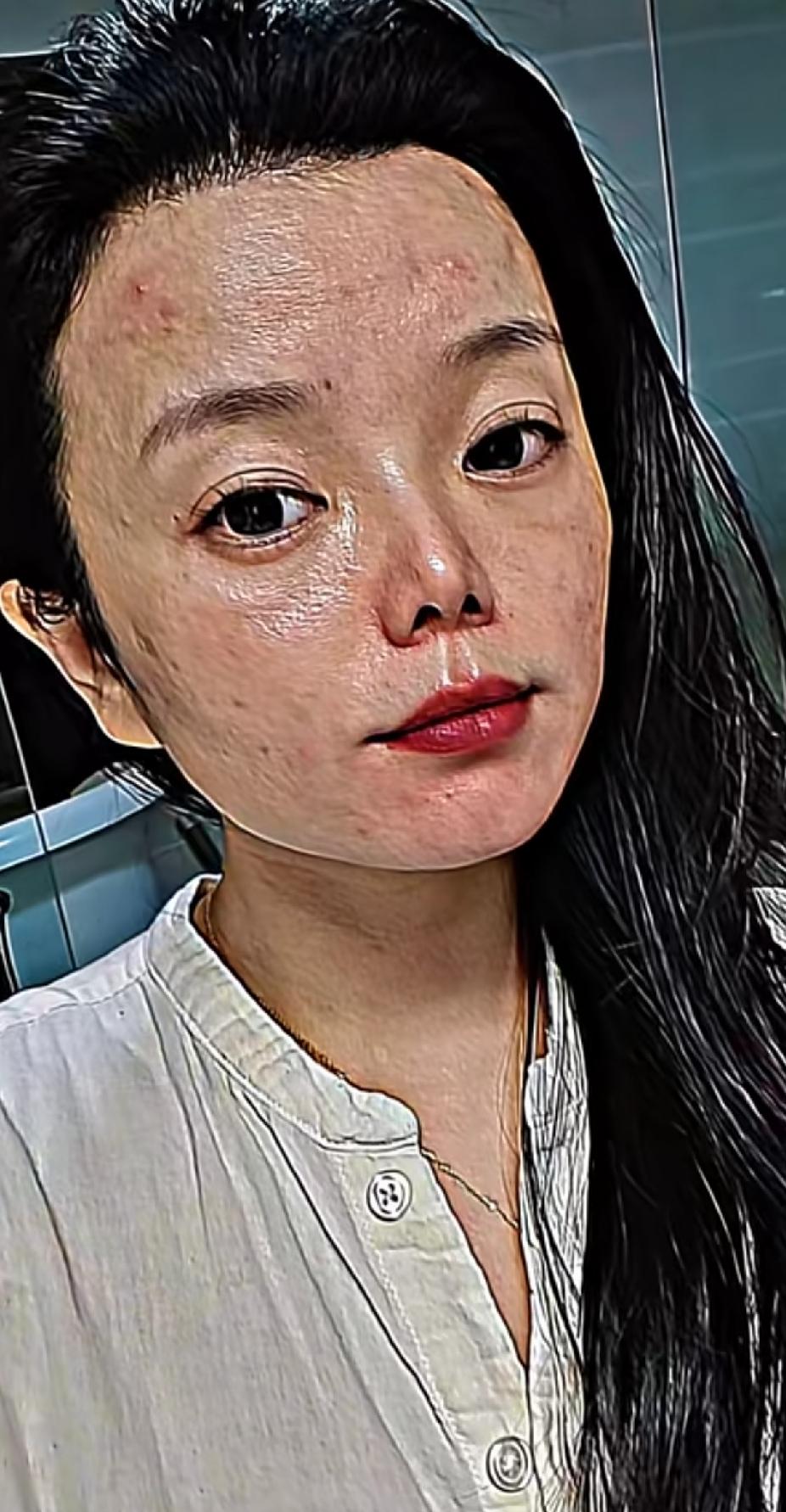 五官好看，可惜皮肤太差了。