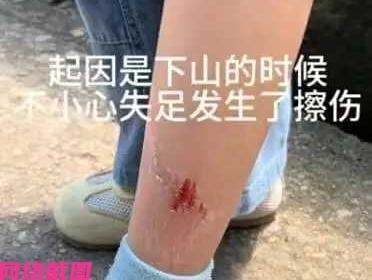 江西某女子带着女儿去龟峰游玩，只是女子的女儿下山时，还不小心摔了一下把小腿破了皮