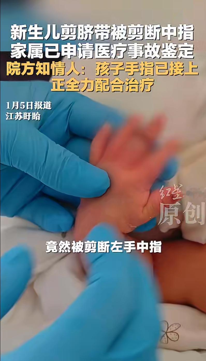 近日，一则令人揪心的消息在网络上引发热议：一名男婴在剪脐带时疑似被助产士不慎剪断
