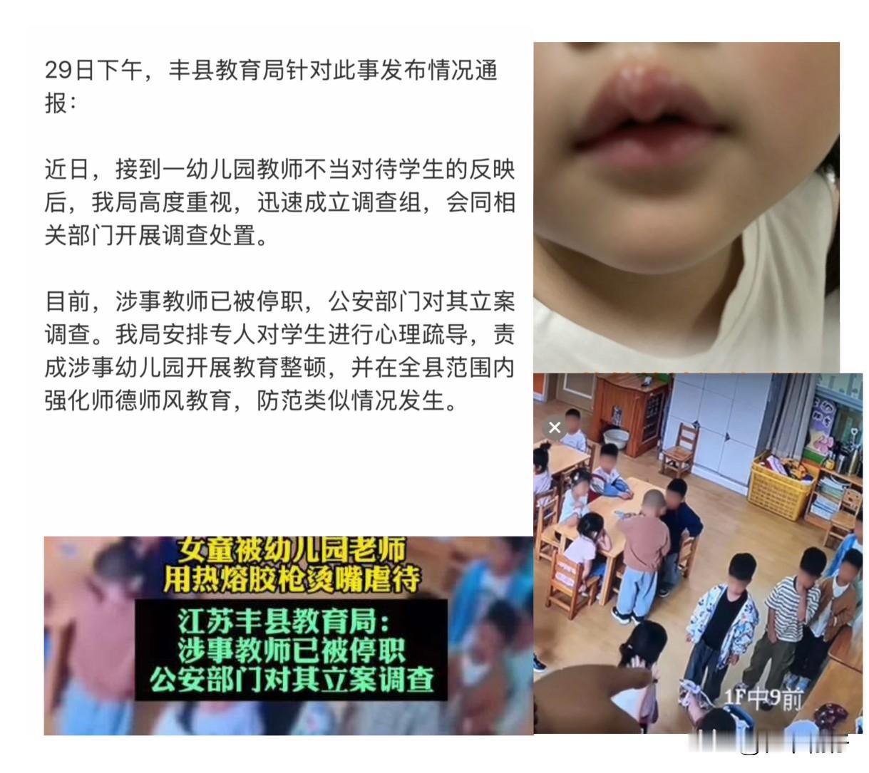 4岁女孩嘴唇被热熔胶枪烫到溃烂，通报来了

徐州丰县机关第二幼儿园这件事，确实让