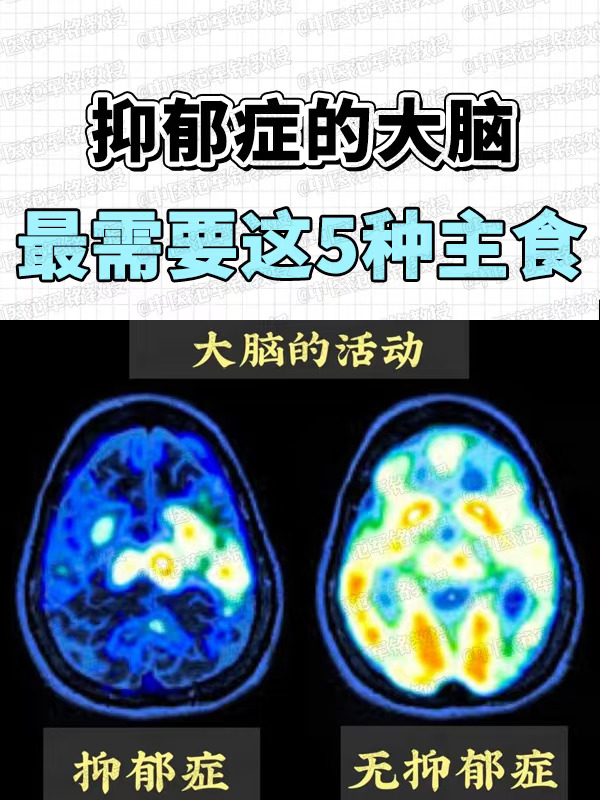 抑郁症的大脑，最需要这5 种主食 . 近期全新研究成果显示，肠道，作为...