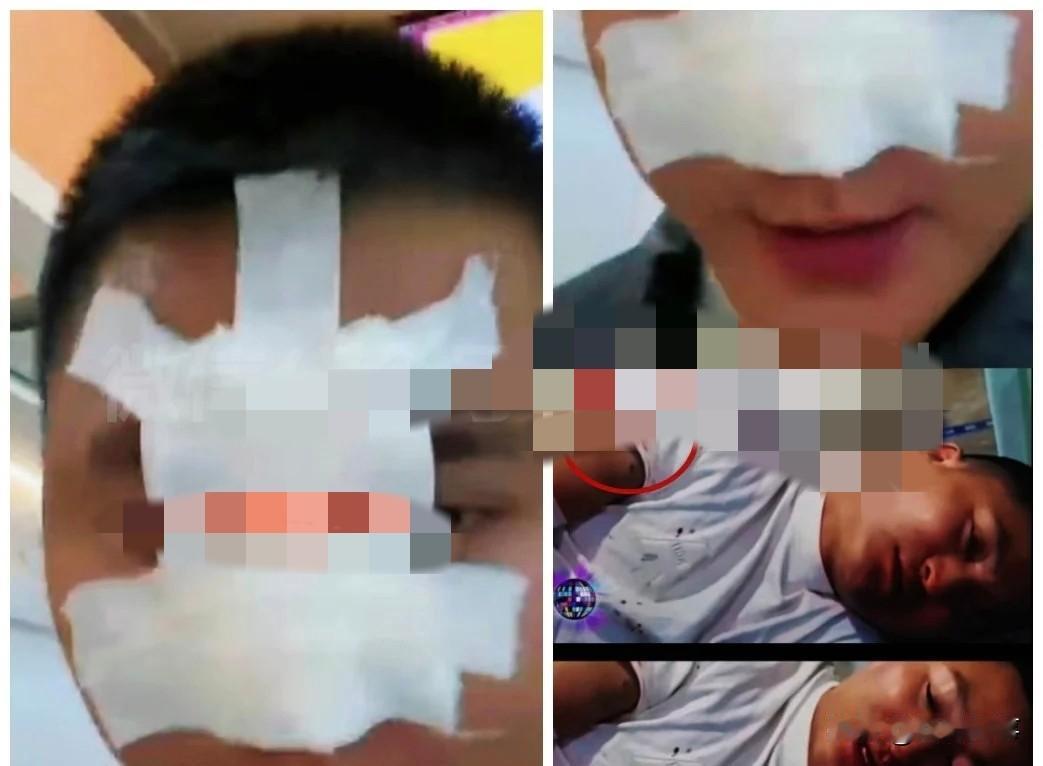 铁岭小辉负伤，倒地不起沾Xue！

          铁岭小辉面部负伤，倒地不