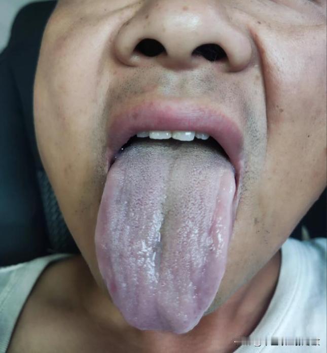 怪不得你脸上长斑，嘴唇黑紫，自己对精子看看舌头[狗头][狗头][狗头]
男人40