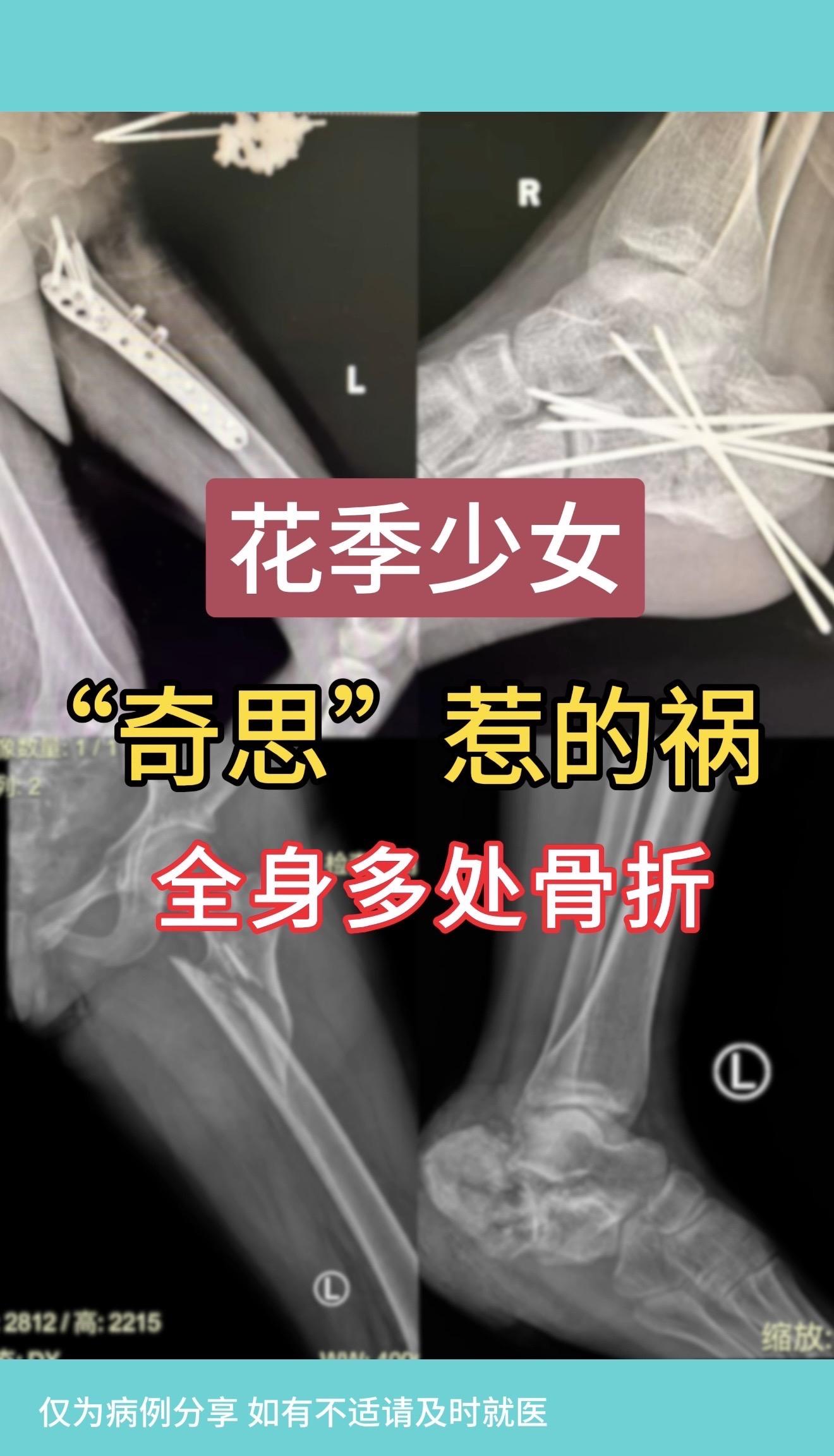 女孩因家人管教，被限制外出，竟“奇思妙想”，仿电影情节，拿一根较细绳子...