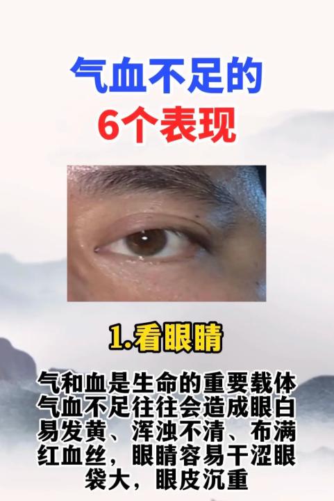 气血亏虚六大典型表现，及早发现及早调养