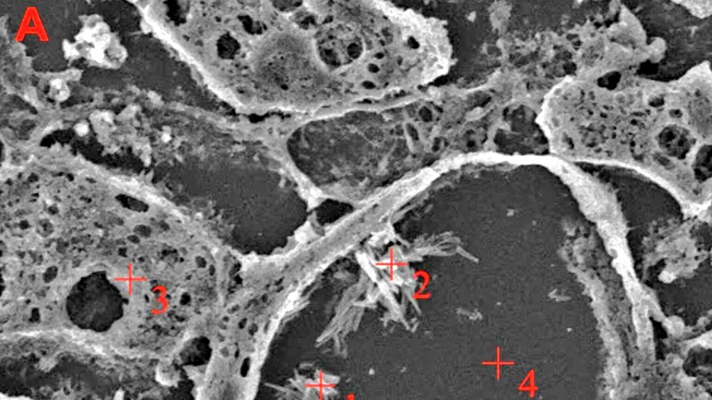 在人类大脑中发现了塑料碎片。研究人员发现，微塑料和纳米塑料的含量比在肝脏或肾脏中