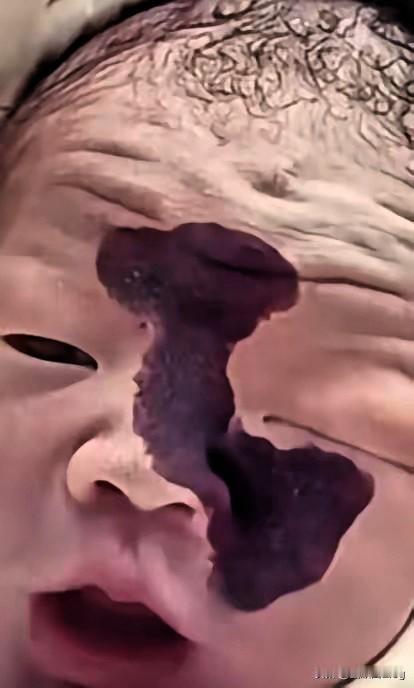 泪目！产检看到宝宝脸上黑影，丈夫当场就想放弃，妻子一句“这是条命”，硬是扛下了所