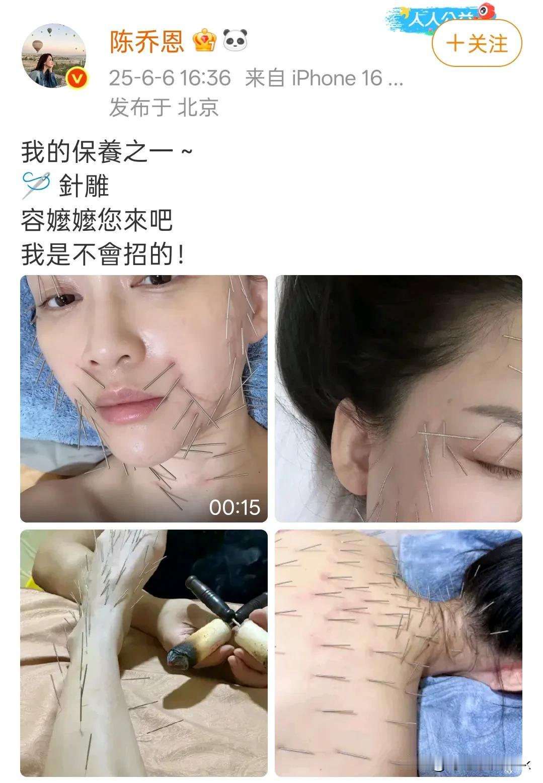原来陈乔恩保养秘籍是全身针雕，看着都疼[呲牙]

果然是能演东方不败的女人，扎别