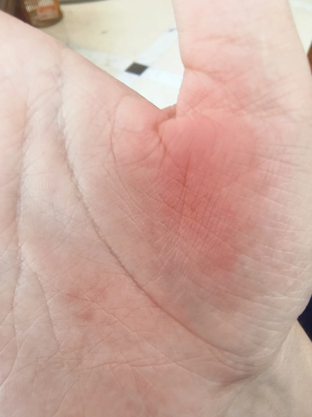 补药再骂我们拧不开瓶盖的死装了
