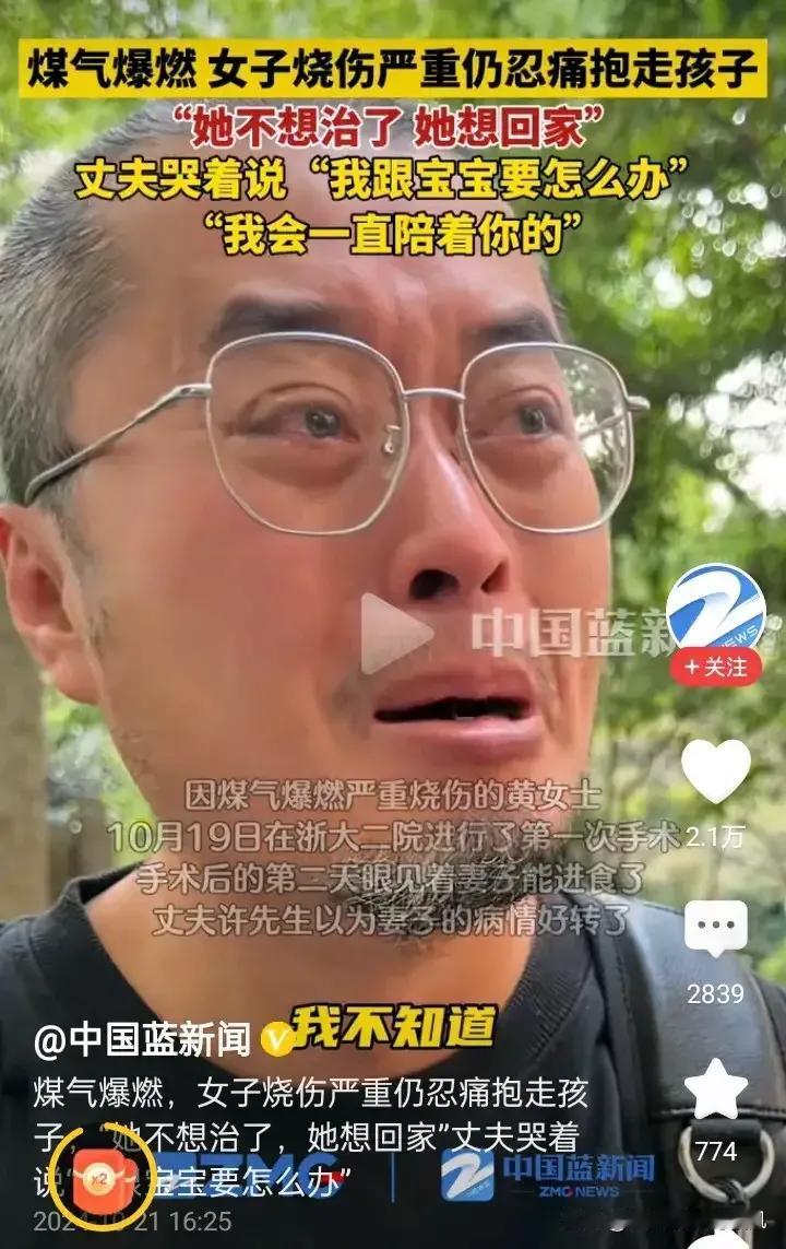 烧伤妈妈迎来诸多好消息。面部留疤方面，若1 - 2周愈合留疤可能性小；烧伤恢复不