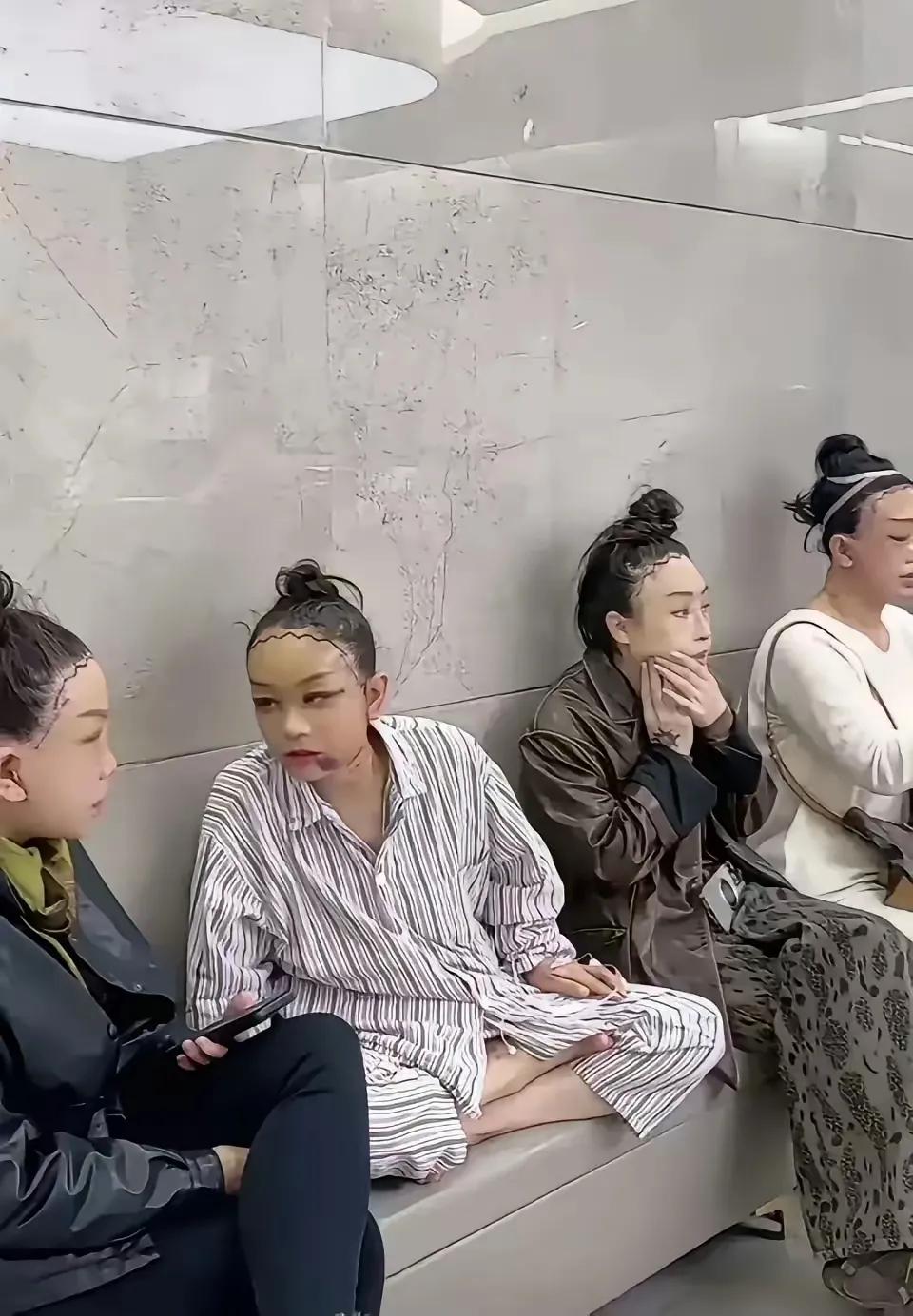 想想女人真可怜，为了美，为了留住青春，在脸上随意动刀，还要排队等待，看来现在医美