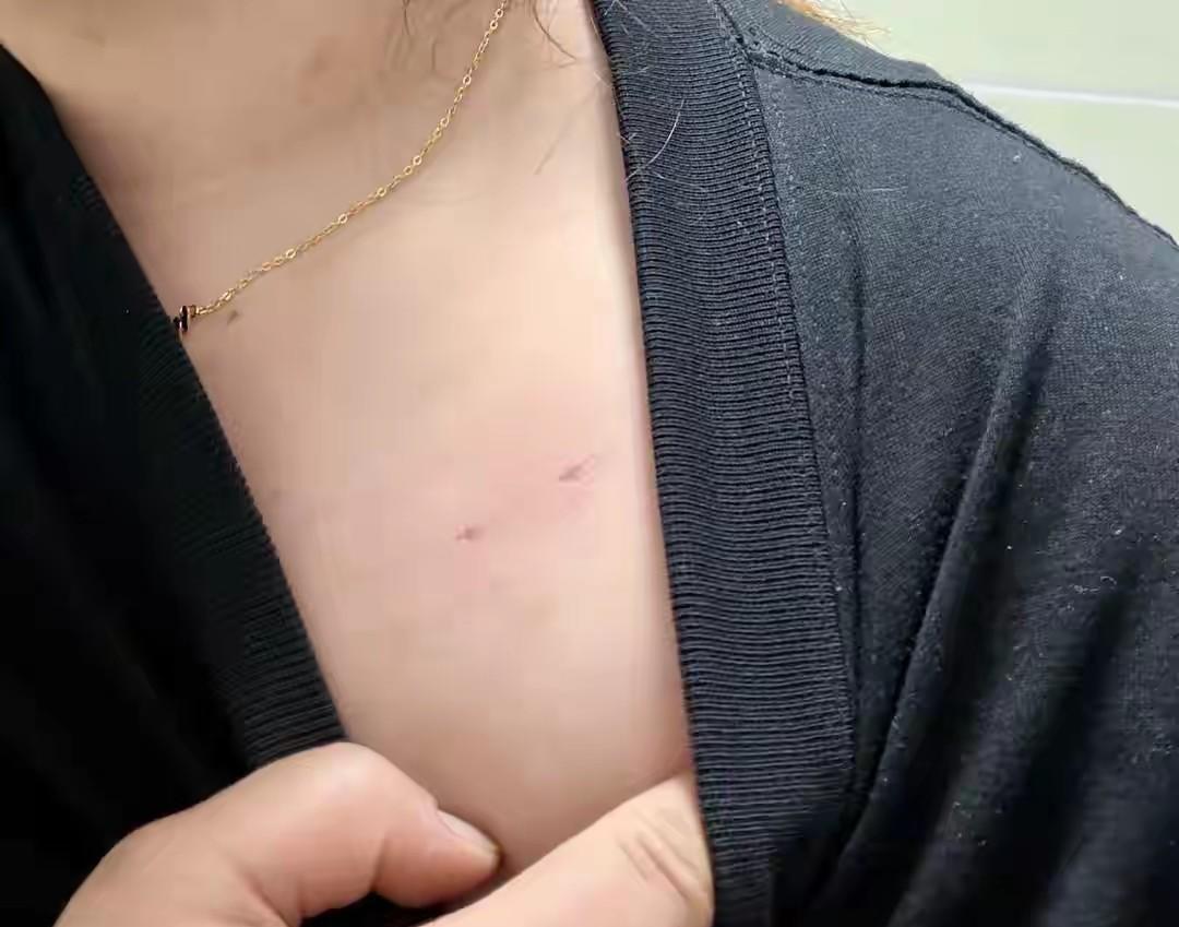 惊魂未定！云南昭通，女子独自在家，正脱了衣服准备洗澡，谁知，一名30多岁的陌生男