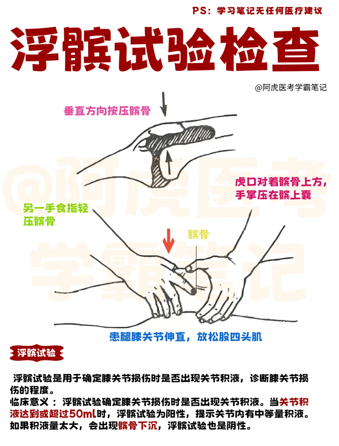 医学生笔记📒｜浮髌试验检查👆