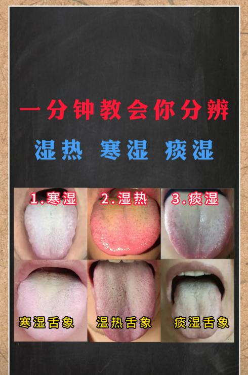 一分钟，教你分清寒湿、湿热、痰湿