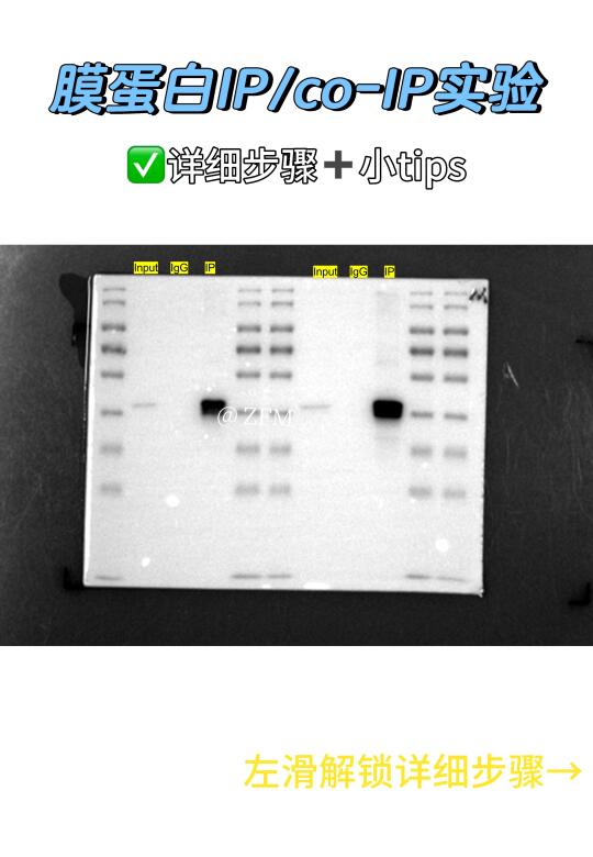 膜蛋白IP/co-IP实验 | 详细步骤➕小tips❗