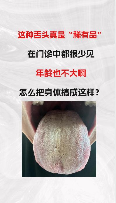 看这个舌象，我可以称它为“稀有品”，因为很少见到，年纪也不大，为什么会把身体搞成