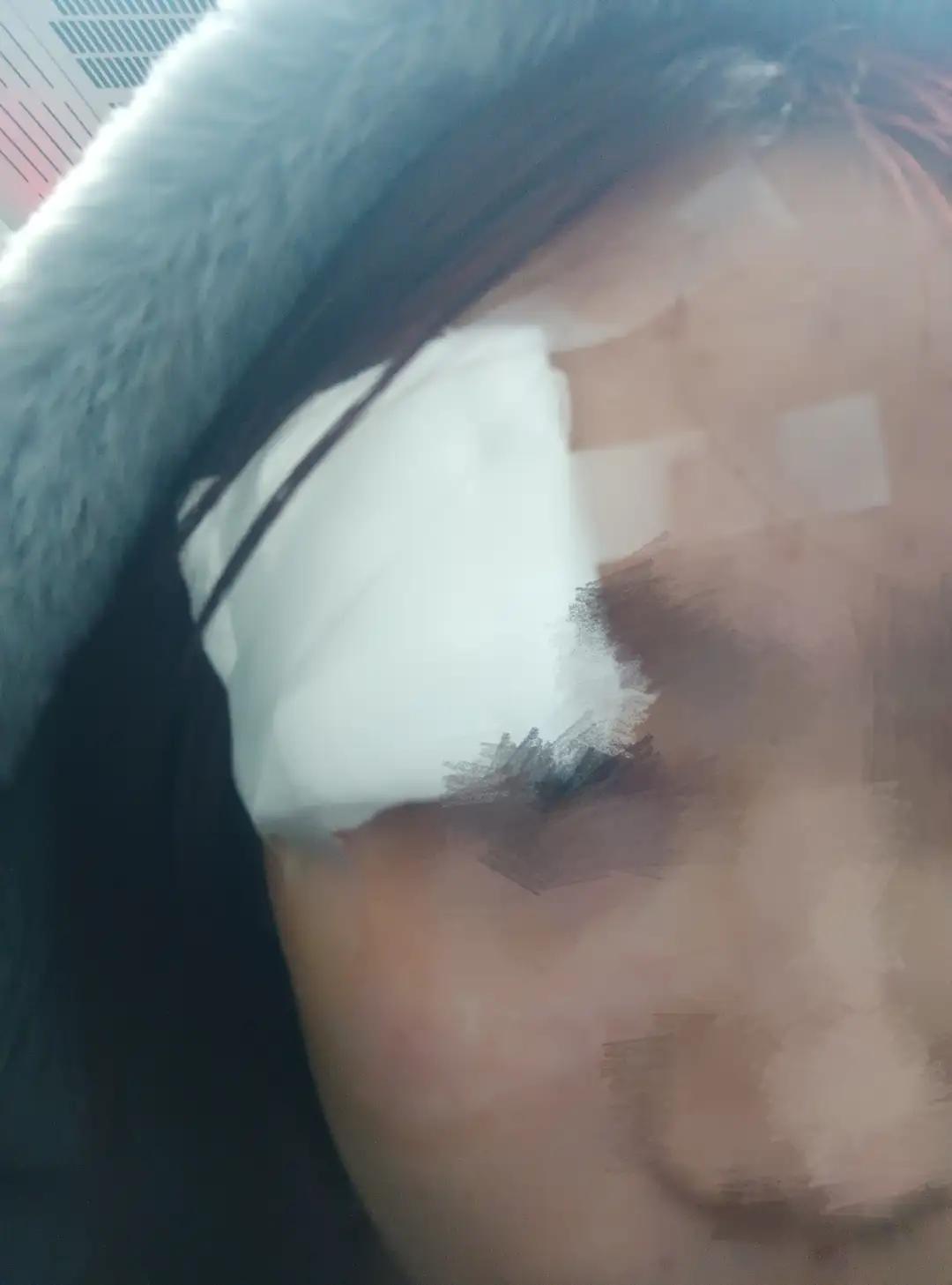 这篇报道讲述了一位女大学生在颐和园意外受伤后，得到一位陌生游客无私帮助的温暖故事