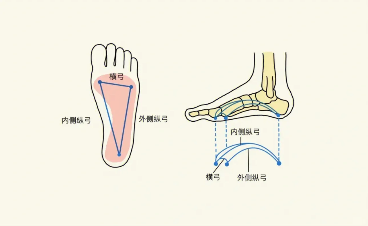 拇外翻术后硌脚原因分析