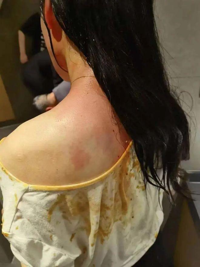 女子不堪家暴持铁管打死丈夫，获刑15年！庭审时她掀起袖口，露出密密麻麻的疤痕，最