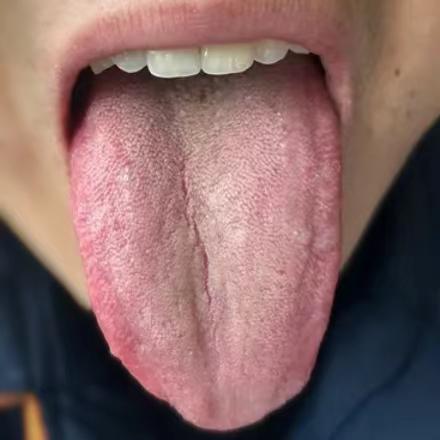 又是典型的虚不受补，补的方面不对，吃再多、再贵的药都没用！
 
患者主诉：房市方
