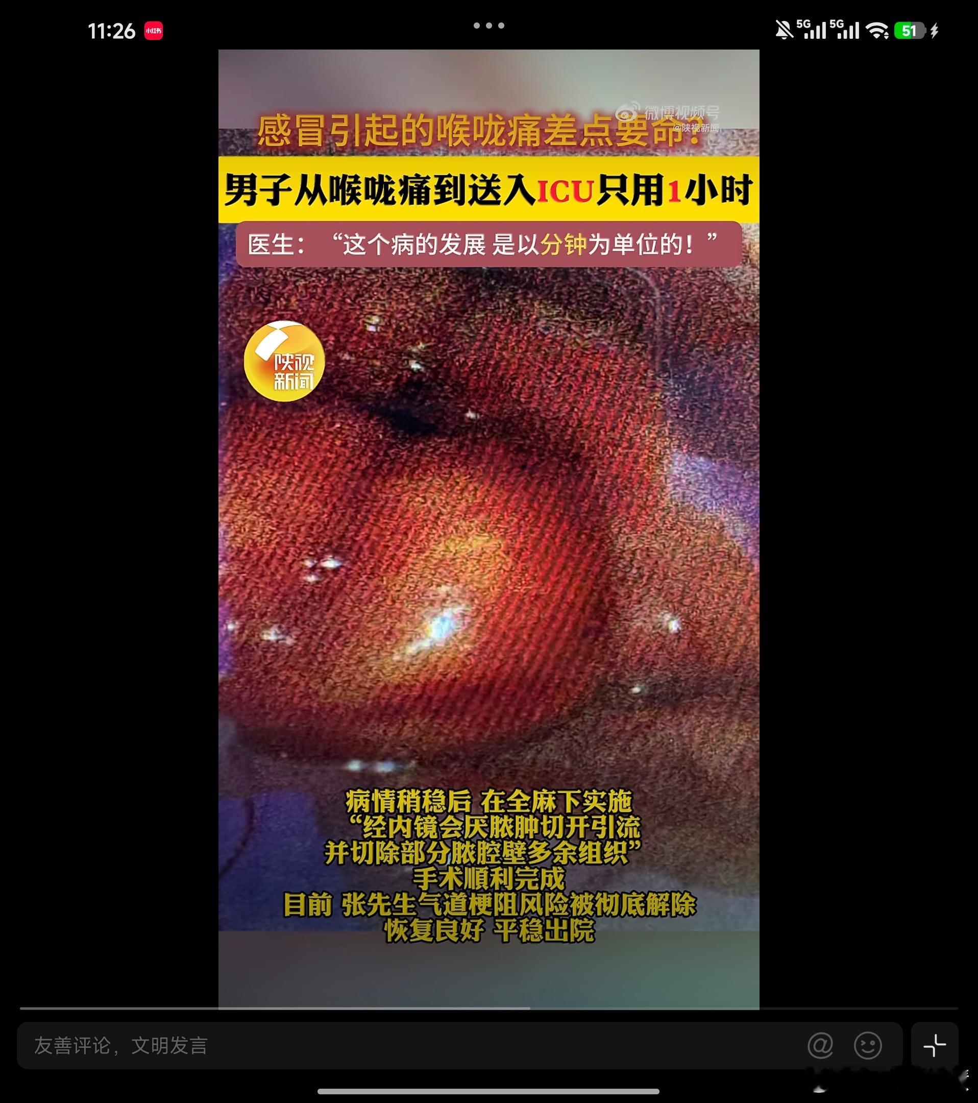 男子从喉咙痛到进ICU只用1小时又学了个新词急性会厌。。。 