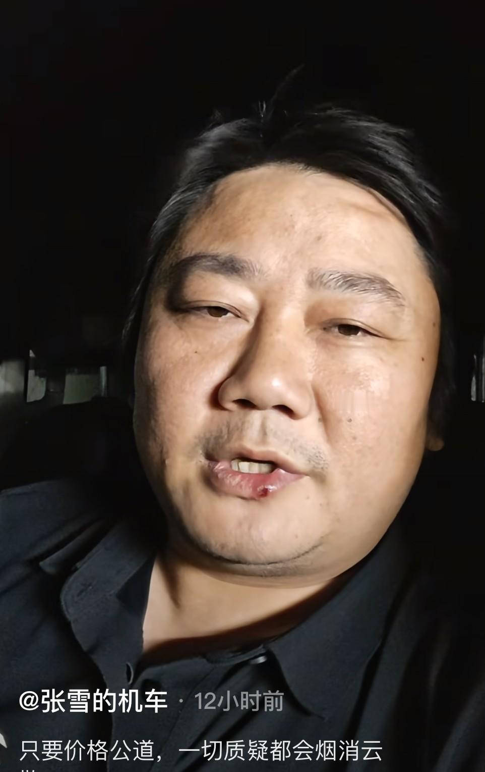 平凡保安的善意，

让我记住了他。

我住的小区有个保安叫小刘，退伍兵，皮肤黑，