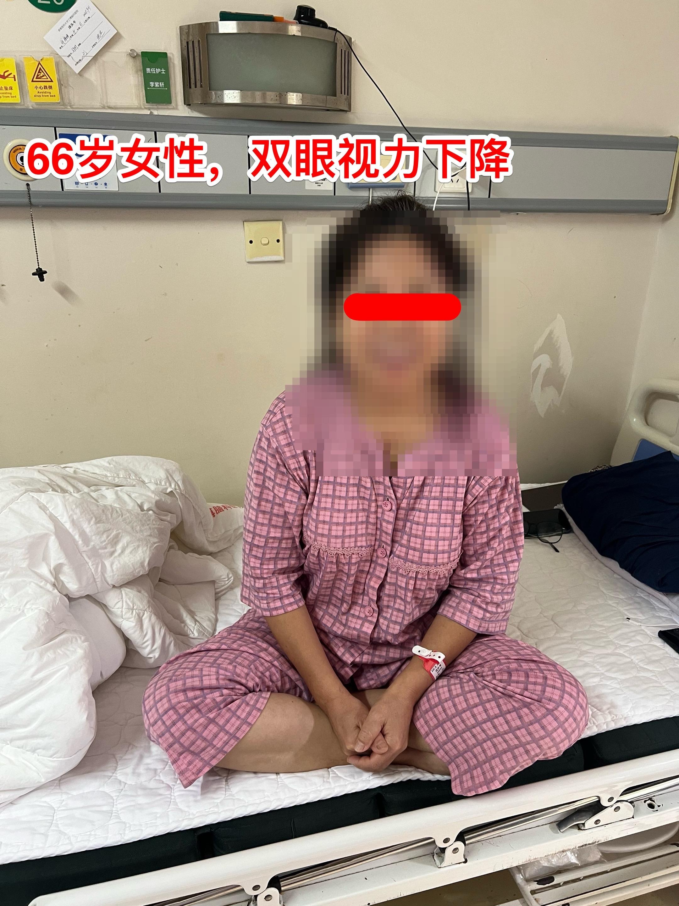脑膜瘤也会造成视力下降。66岁吉林省女性，退休后喜欢开车到处旅游，并在...
