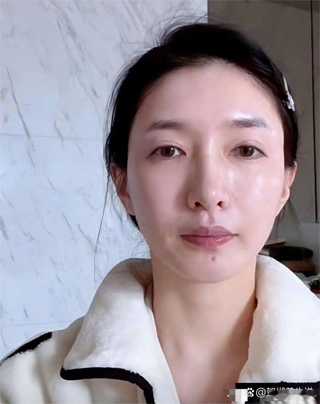 江疏影素颜出镜，皮肤泛油有痘，她手涂口红笑容甜美 ​​​